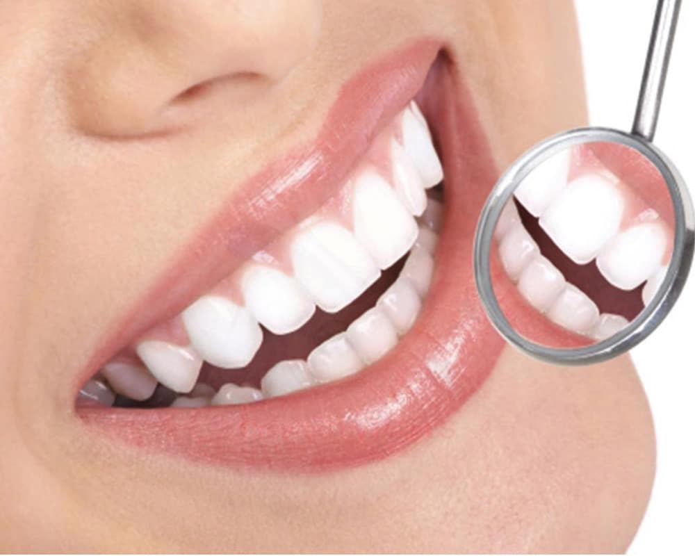 teeth whitening Marrickville